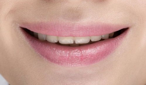 2024广州优雅联合口腔门诊部收费标准一览 拔牙|半口种植牙|补牙|种牙费用公开