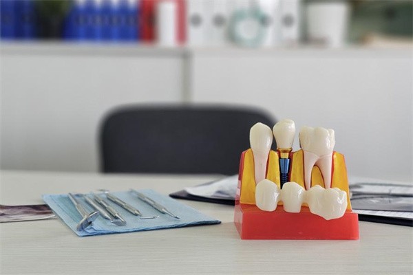 进口种植牙值不值得？对比ITI/诺贝尔与国产在价格、售后和临床数据的差异