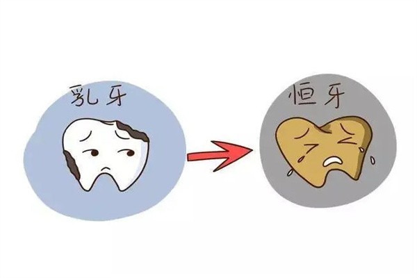 儿童乳牙补牙用哪些材料更靠谱？氟化物、树脂与家长护理注意事项别错过