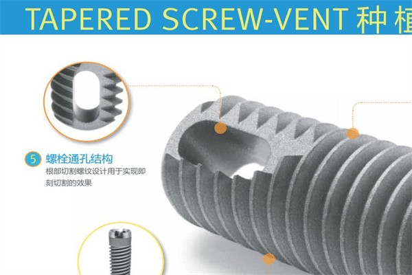 大陆做种植牙多少钱?不同品牌植体及价格详细分享收费约2千元一颗起