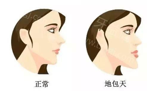 新版上海雅伊口腔价格表 隐形矫正/根管治疗/地包天矫正/牙齿矫正费用不贵