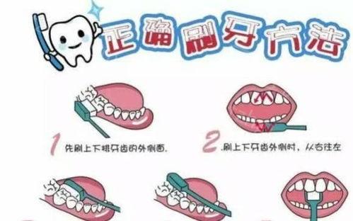微创牙齿冷光美白有何特殊之处?全程分为几个步骤?