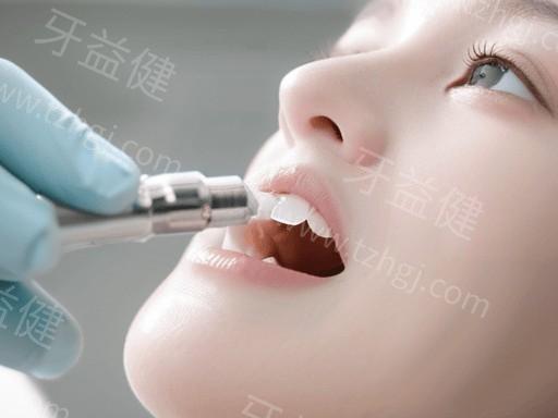 做瑞典尼奥斯亲水种植牙前，饮食有什么忌口的注意事项？
