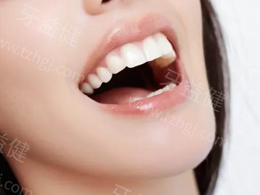 做活动矫正器后，可以吃辛辣的食物吗？了解后让你更安心！