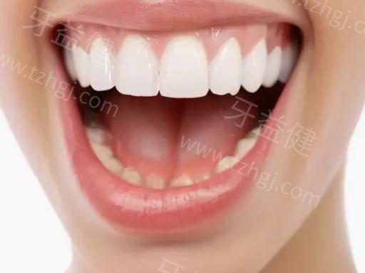 做烤瓷牙前有什么忌口的？了解这些饮食禁忌才能确保效果更佳！