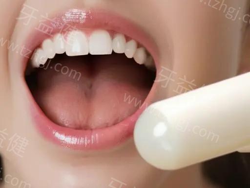 做欧睛自锁托槽的过程主要有哪些步骤？让你轻松掌握正畸新趋势！