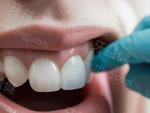 固德口腔是正规私立牙科!种植牙矫正口碑技术好+2025价格表+地址一览