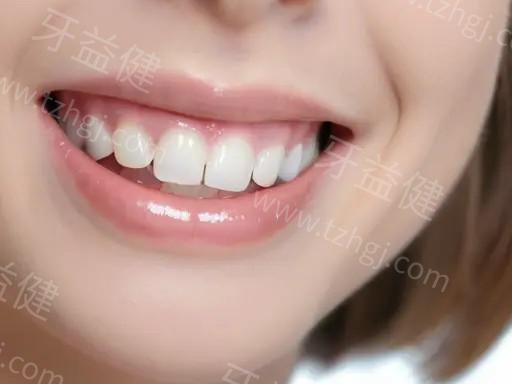 新版南京牙科的医院全瓷牙要多少钱 聚合瓷全瓷牙500|拉瓦全瓷牙2000