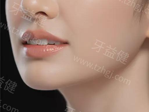做瑞典诺贝尔pmc种植牙的过程，主要有哪些步骤？了解一下吧！