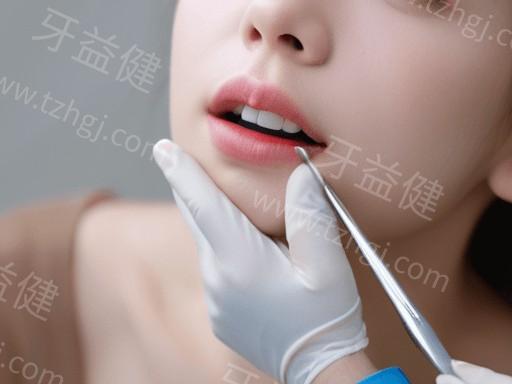 更新成都牙科的医院补牙收费贵吗 补牙、3M树脂补牙、儿童全口涂氟、日本玻璃离子补牙部分有折扣