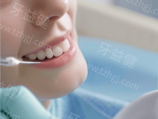 更新无锡牙科的医院牙齿美白收费标准一览 冷光美白2000/洗牙300元起
