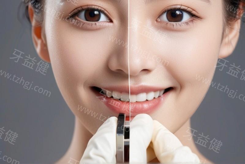 重庆正畸排名前十的口腔医院！美奥/团圆/维乐正畸技术优